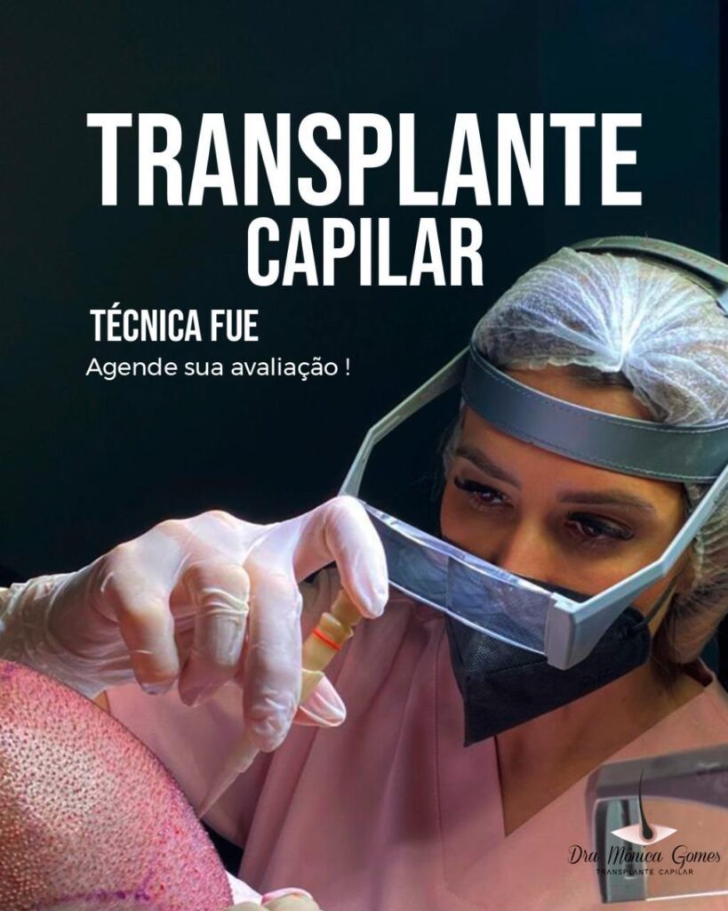 Dra. Mônica Gomes: Referência em Transplante Capilar e Tricologia Médica 3 d0337c5d ac1b 4363 8a65 459db6e24bc3